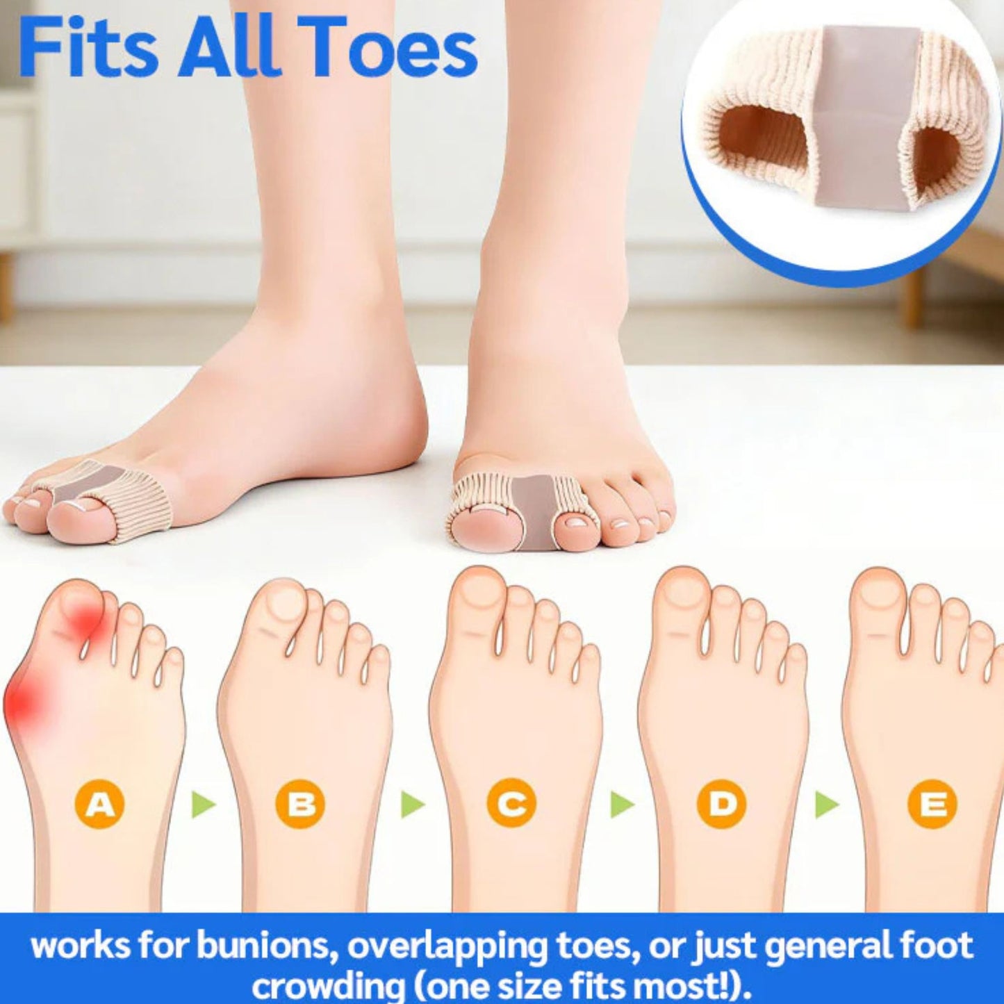 𦶠Bunion Relief Toe Separator