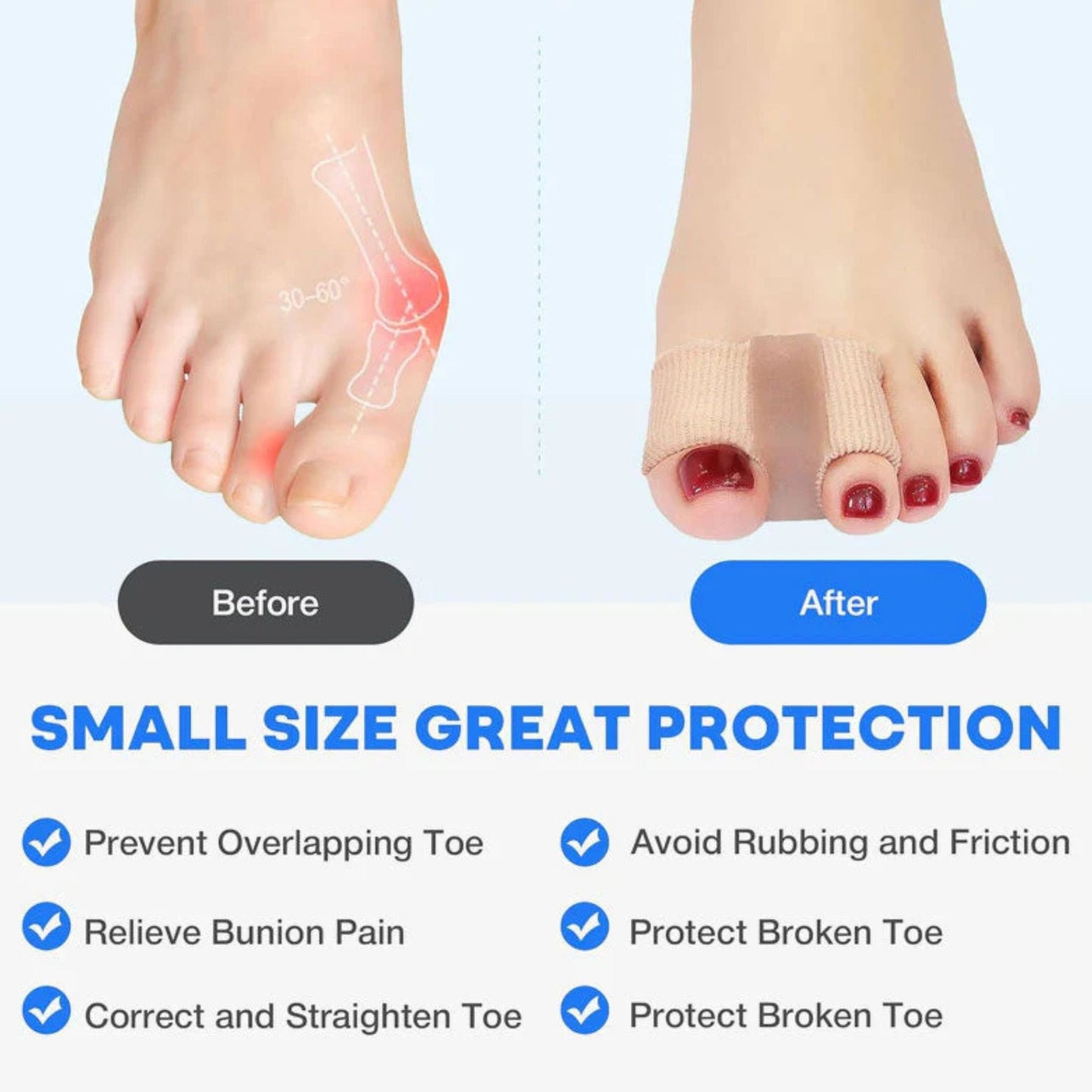 🦶 Bunion Relief Toe Separator