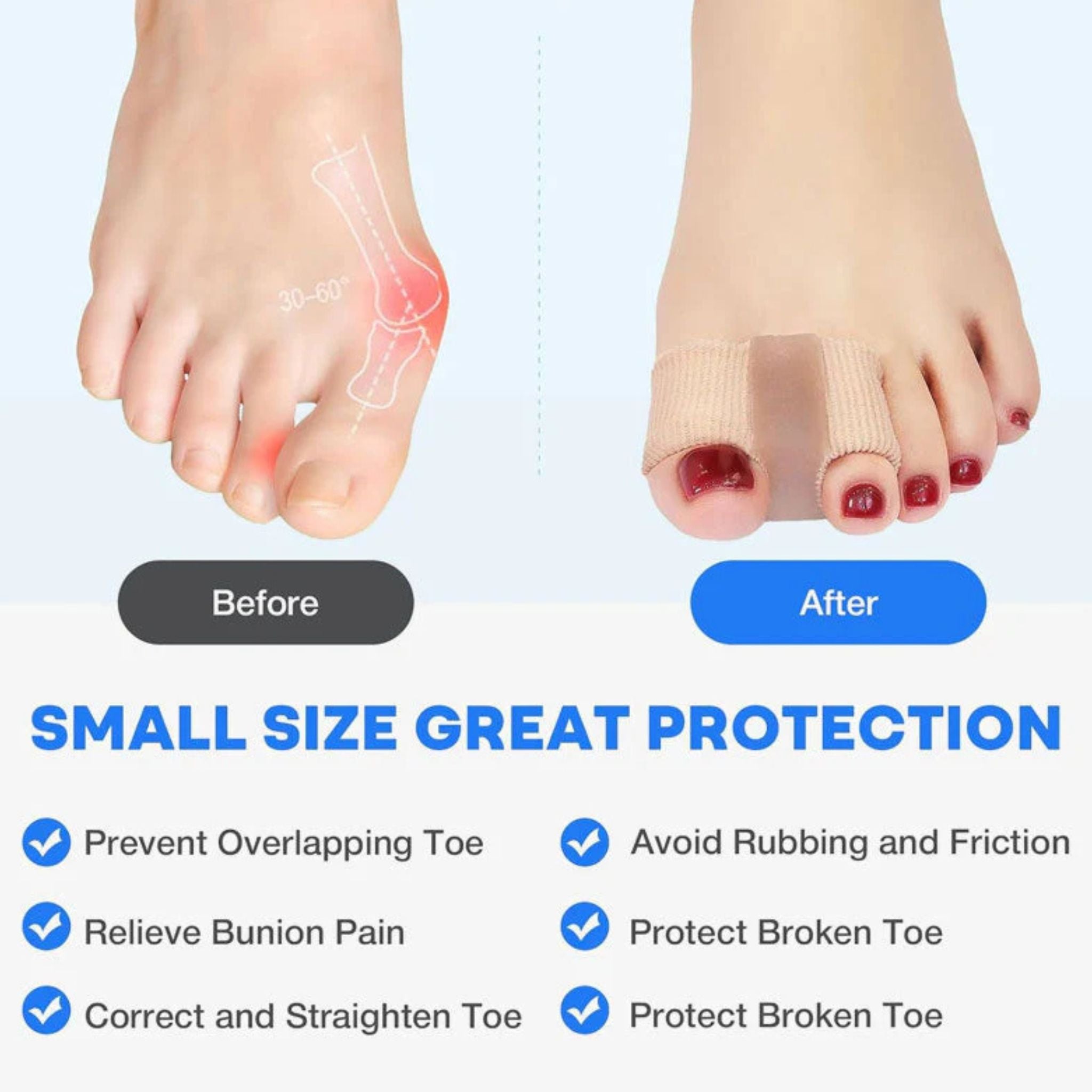 🦶 Bunion Relief Toe Separator